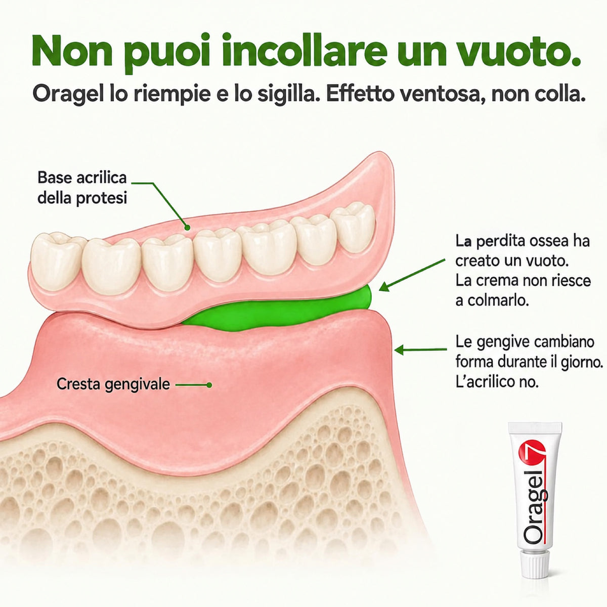 Oragel™ — Dentiera Ferma al 100%, Tenuta Sicura Tutto il Giorno