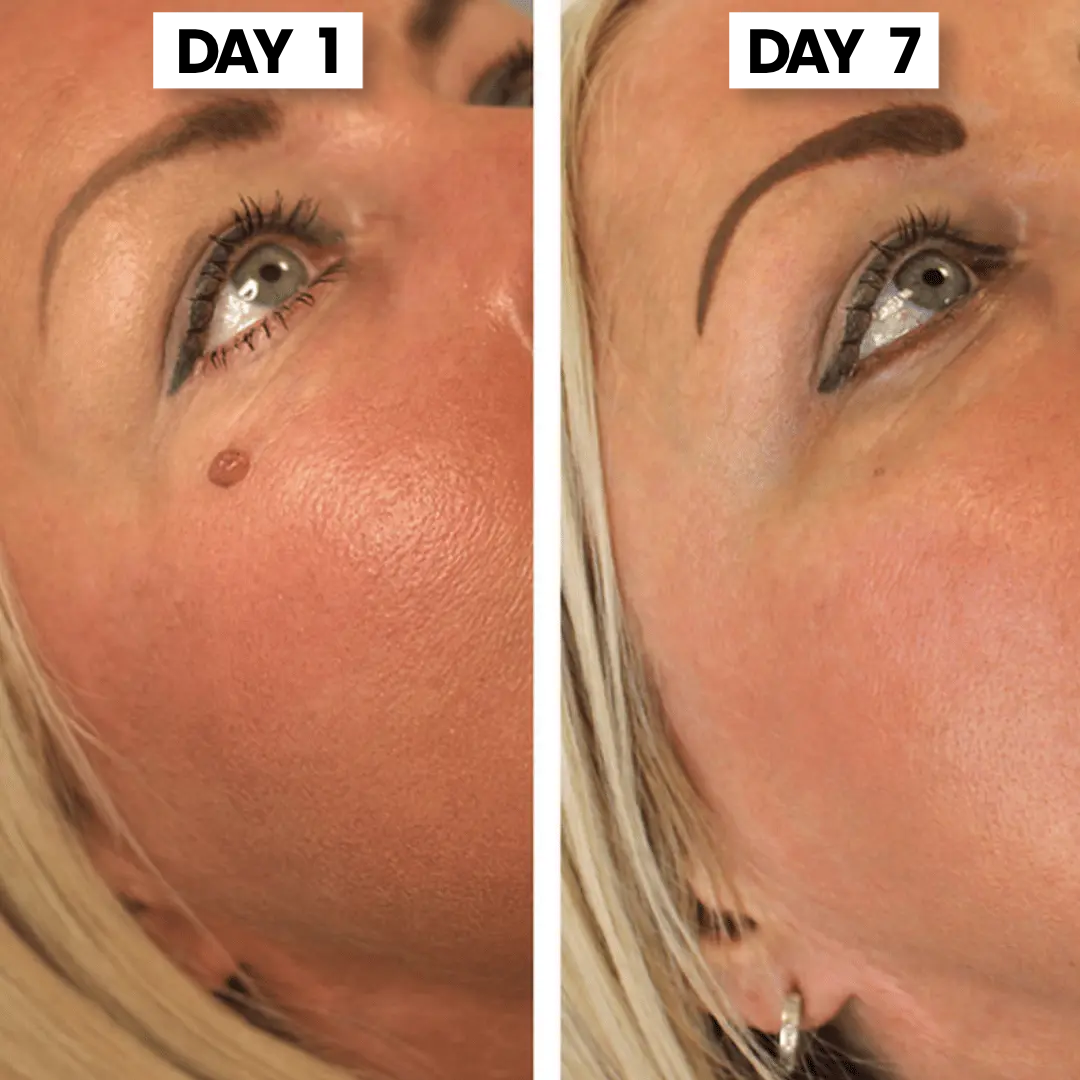 ClearSkin Tag™