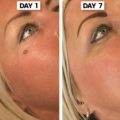 ClearSkin Tag™