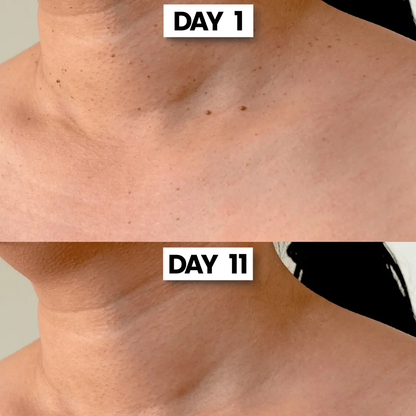 ClearSkin Tag™