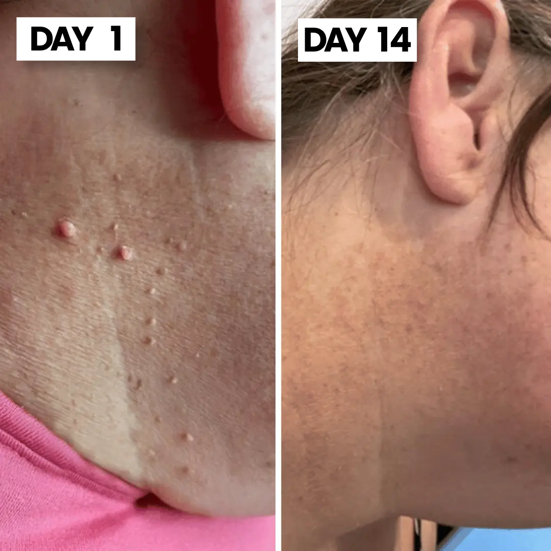 ClearSkin Tag™