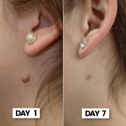 ClearSkin Tag™