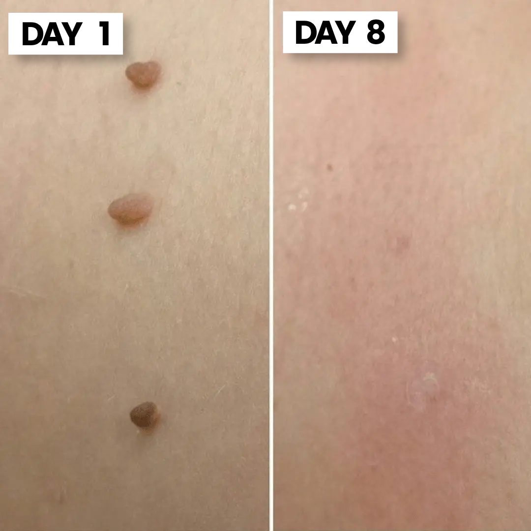 ClearSkin Tag™