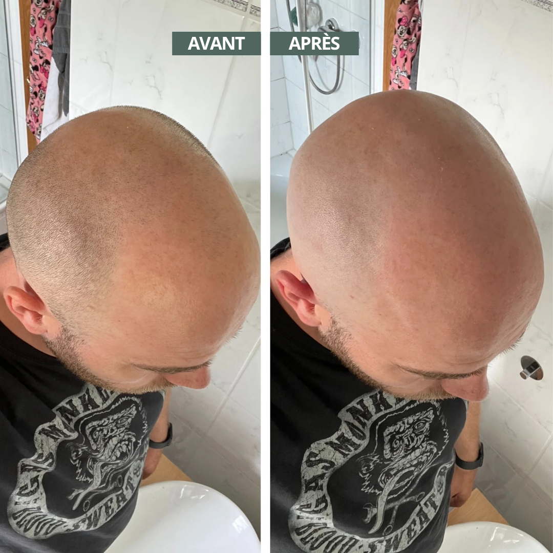 ShavePro™ - Rasoir pour crâne