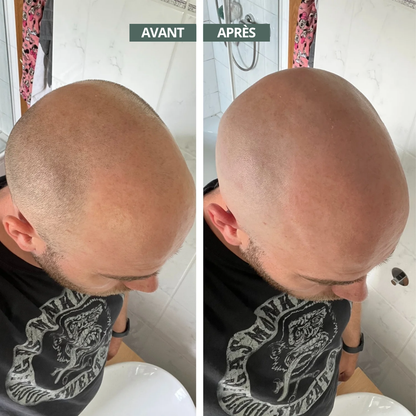 ShavePro™ - Rasoir pour crâne